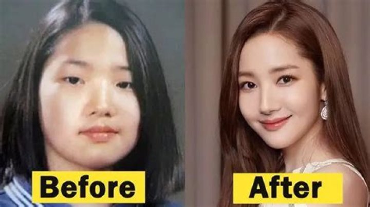 Park Min Young's Plastic Surgery Journey