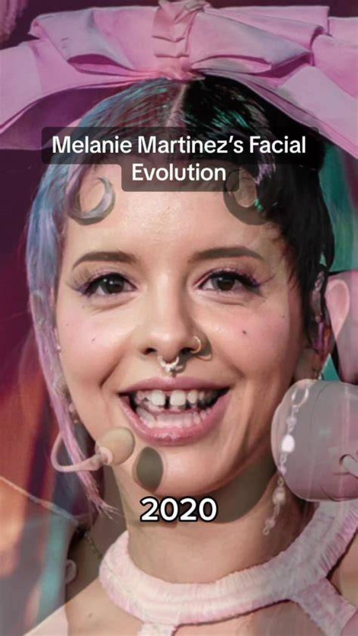 Unveiling Melanie Martinez's Surgical Transformations: Truth Or Speculation?